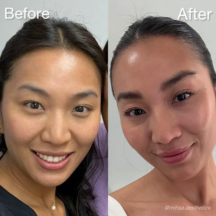 MIHSA Aesthetics Picture 10