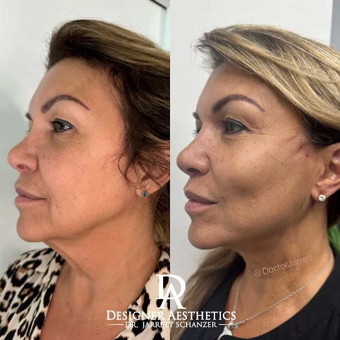 Designer Aesthetics by Dr. Jarrett Schanzer Picture 6