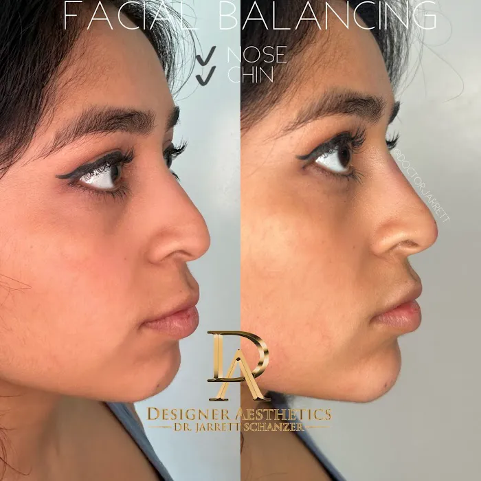 Designer Aesthetics by Dr. Jarrett Schanzer Picture 9