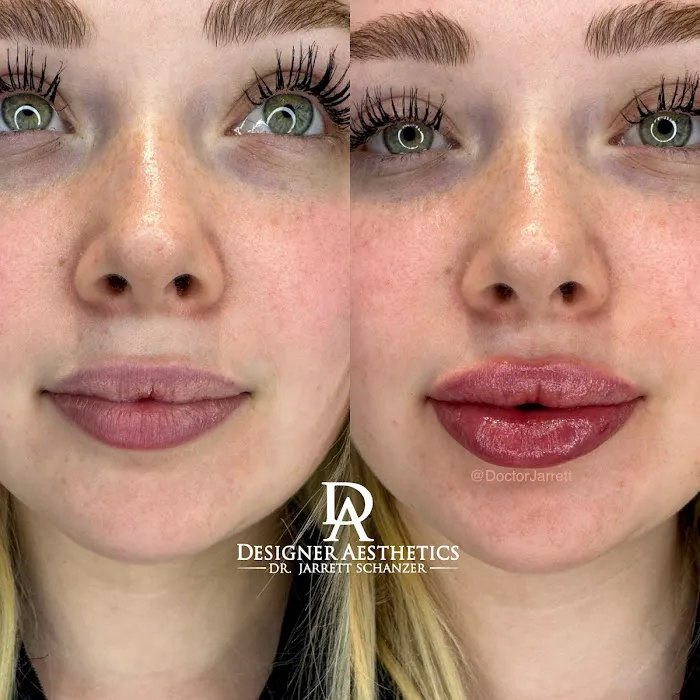 Designer Aesthetics by Dr. Jarrett Schanzer Picture 10