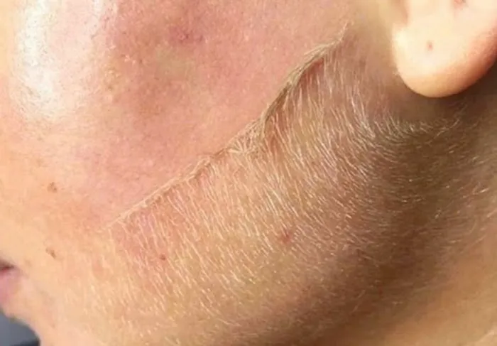 Ultimate Skin Care Picture 4