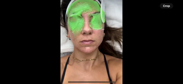 Skin Beauty Sol Picture 2