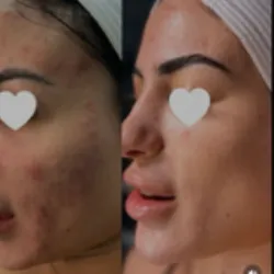 Skin Beauty Sol Picture 7