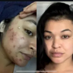 Skin Beauty Sol Picture 8