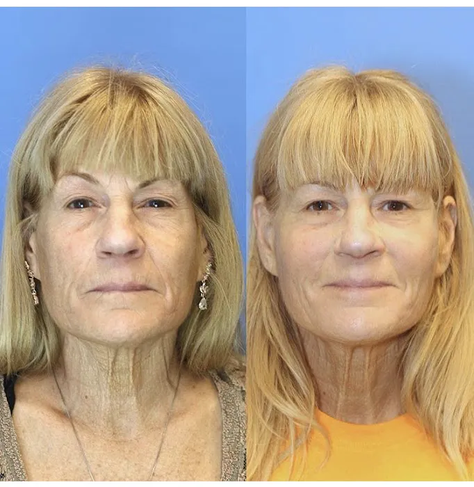 RejuvéNationInjectors - Medical Spa at The Kaplan Center Picture 6