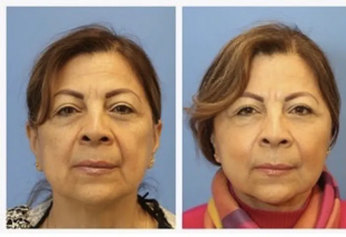 RejuvéNationInjectors - Medical Spa at The Kaplan Center Picture 10