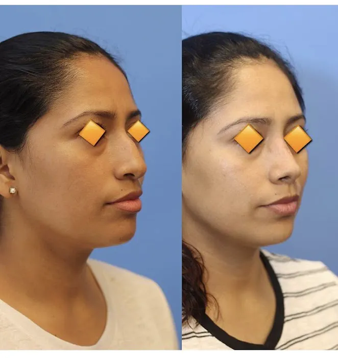 RejuvéNationInjectors - Medical Spa at The Kaplan Center Picture 8