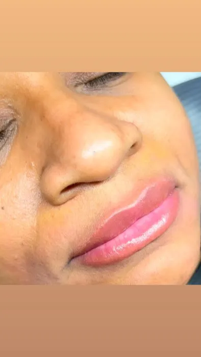 BBE AESTHETICS Picture 4