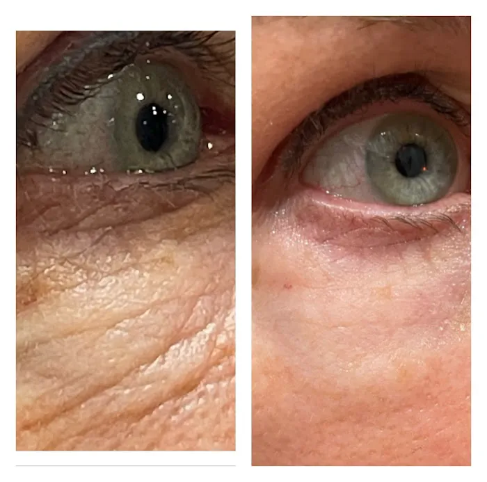 Glow Skin Club Picture 9