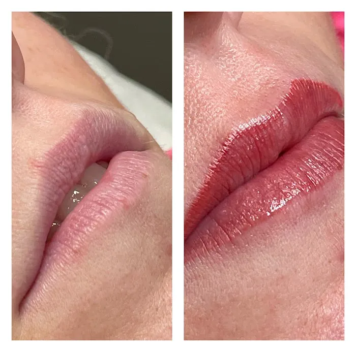 Glow Skin Club Picture 4