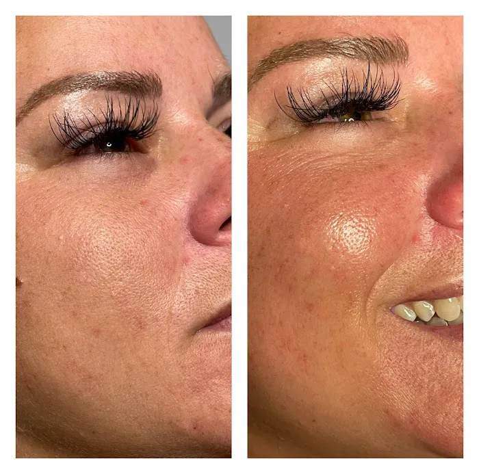 Glow Skin Club Picture 5