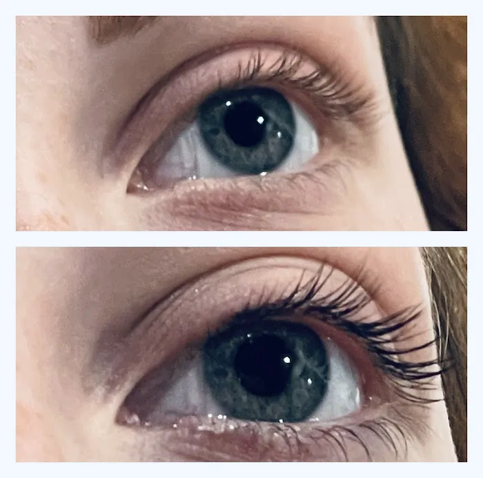 Glow Skin Club Picture 8