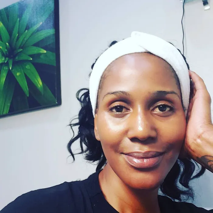 Refreshhh Skin Clinic Picture 9