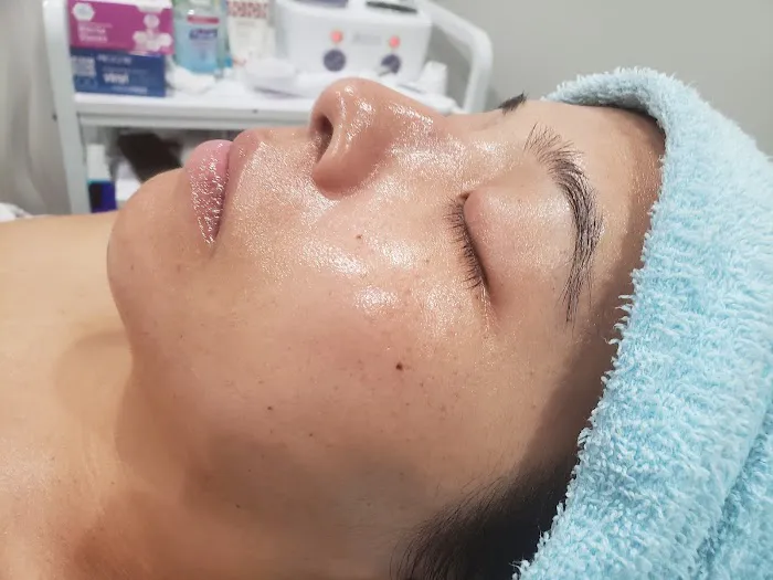 Refreshhh Skin Clinic Picture 8