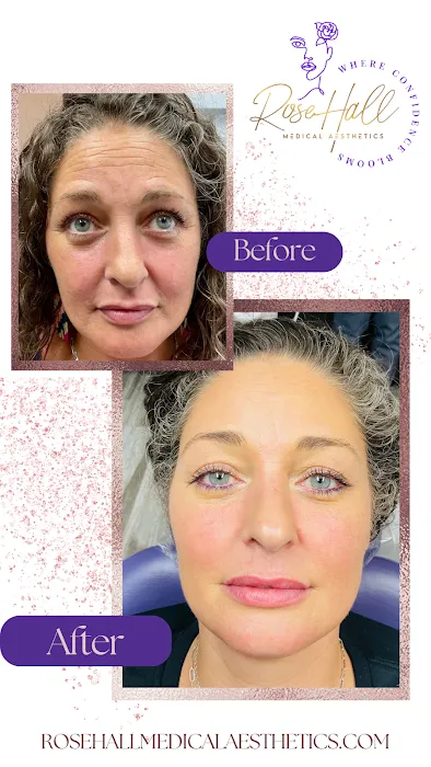 RoseHall Medical Aesthetics Picture 3