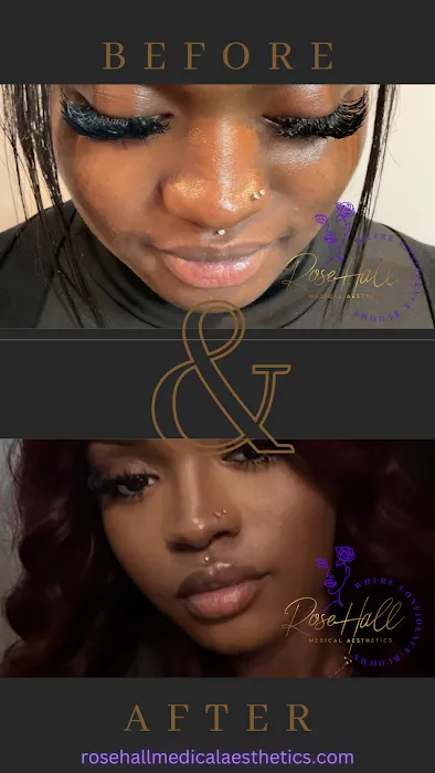 RoseHall Medical Aesthetics Picture 4