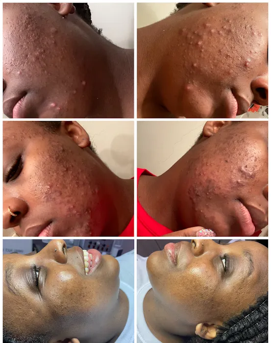 BLCK Label Aesthetics Studio Picture 8