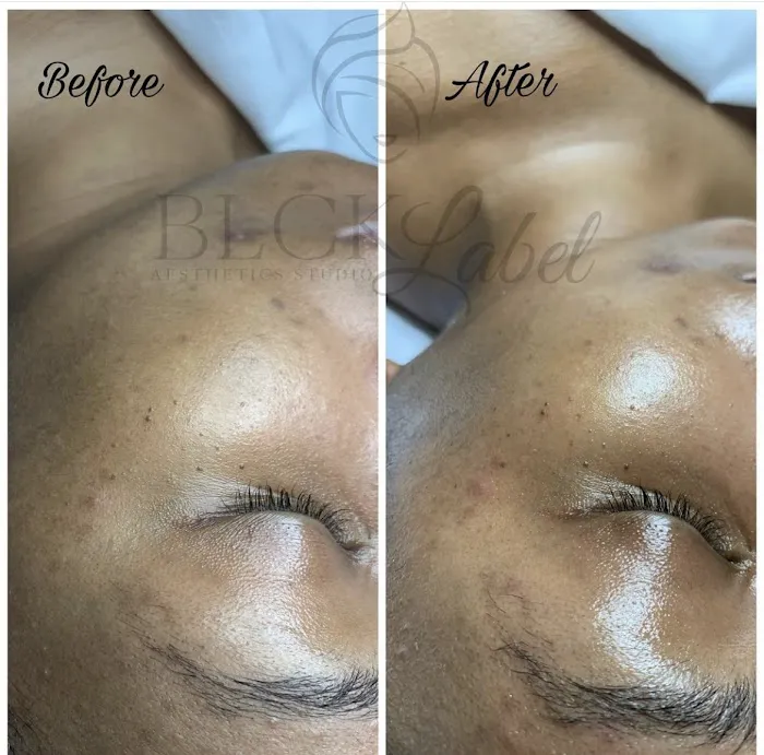 BLCK Label Aesthetics Studio Picture 10