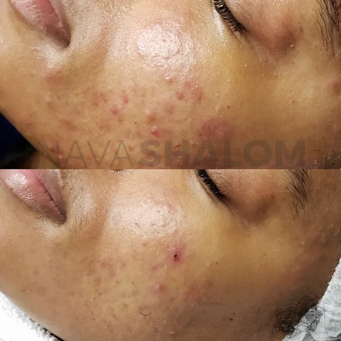 NAVASHALOM SKIN STUDIO Picture 8