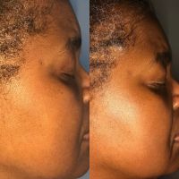 Everlasting Beauti LLC ico