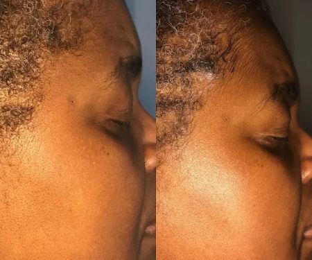 Everlasting Beauti LLC