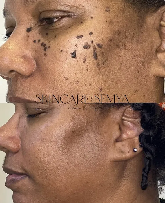 Skincare by Semya Picture 1