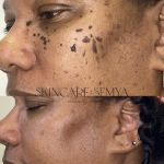 Skincare by Semya