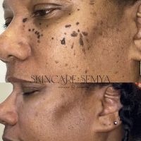 Skincare by Semya ico