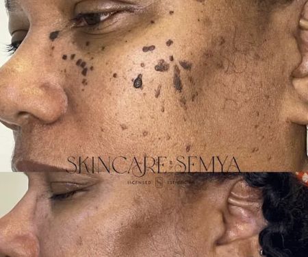Skincare by Semya