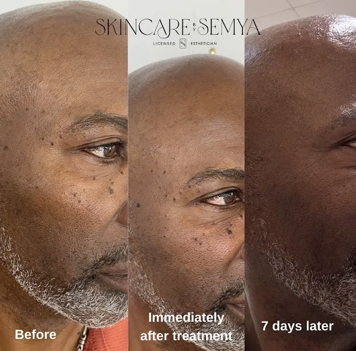 Skincare by Semya Picture 2