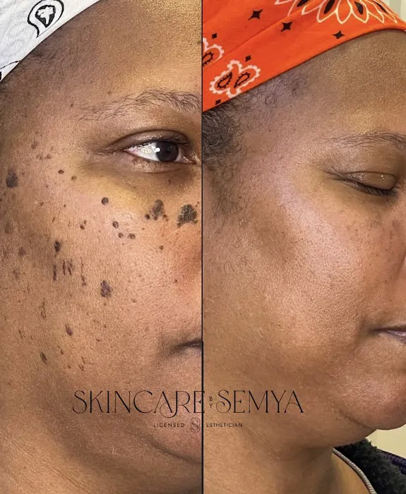 Skincare by Semya Picture 4