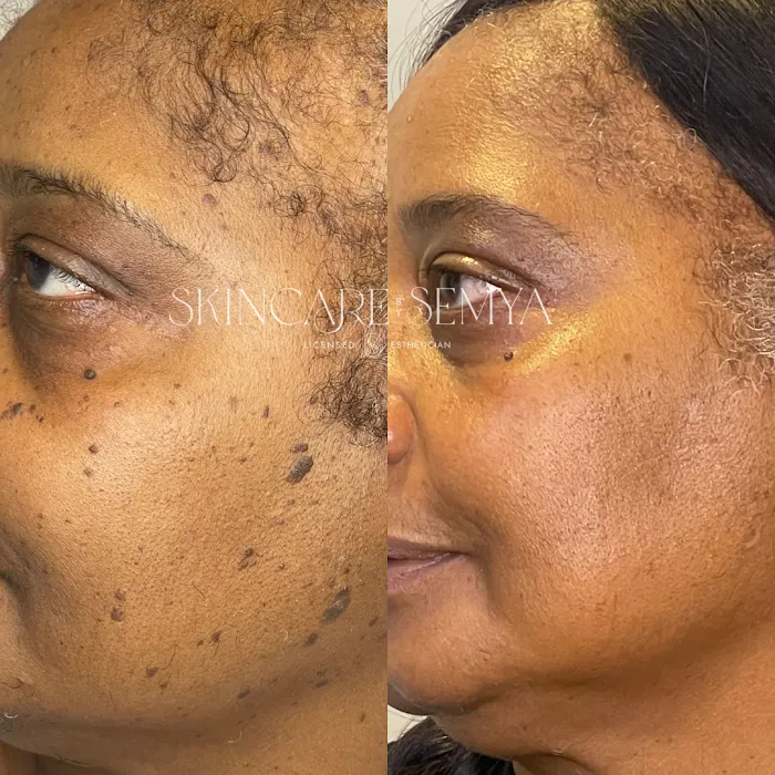 Skincare by Semya Picture 3