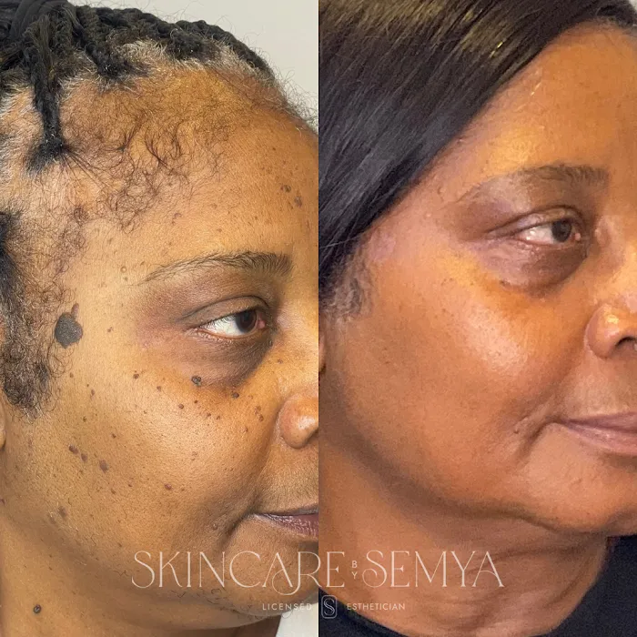 Skincare by Semya Picture 5