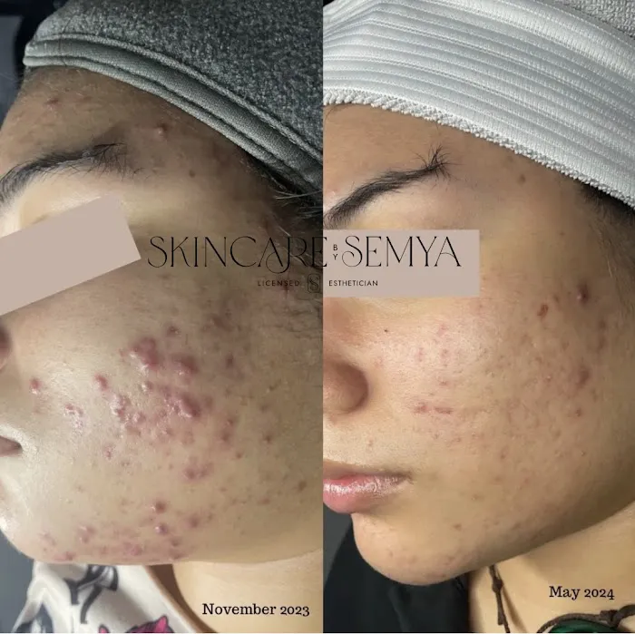 Skincare by Semya Picture 6