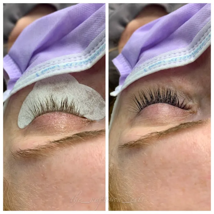 Naptown Esthetics Collective Picture 9