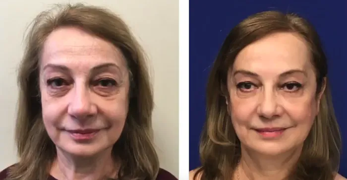 Chevy Chase Cosmetic & Dermatology Center, an Affiliate of Anne Arundel Dermatology Picture 6