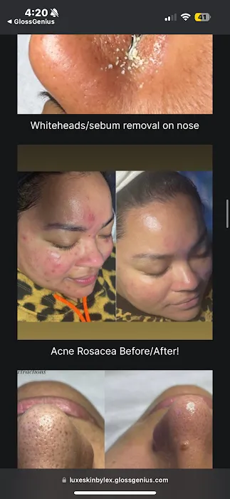 Luxe Skin by Lex Picture 9