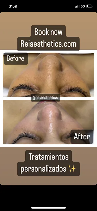 Rei’A Esthetics Picture 6