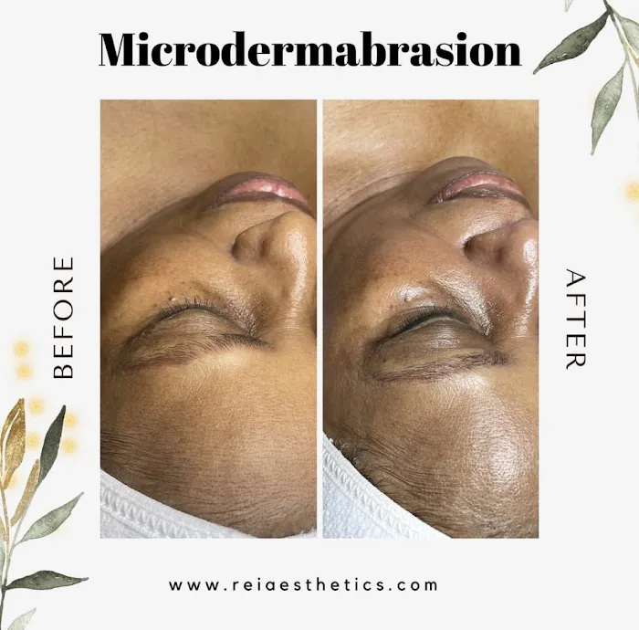 Rei’A Esthetics Picture 4