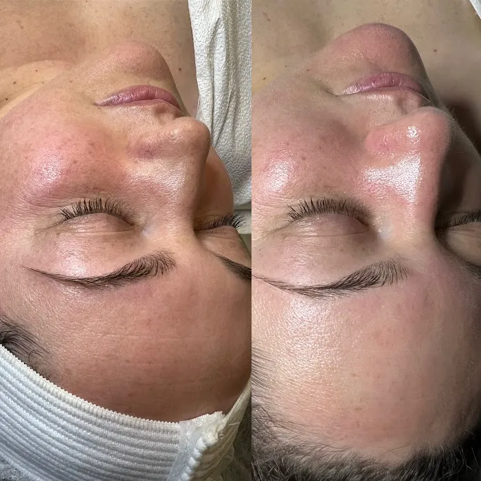 Esthetic Generation Picture 9