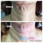 Simply Skin Laser Medispa