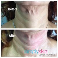 Simply Skin Laser Medispa ico