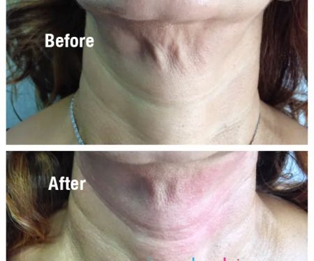 Simply Skin Laser Medispa