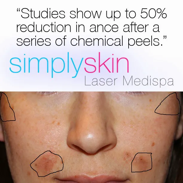 Simply Skin Laser Medispa Picture 2