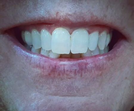 Red Clover Massage & Med-Spa