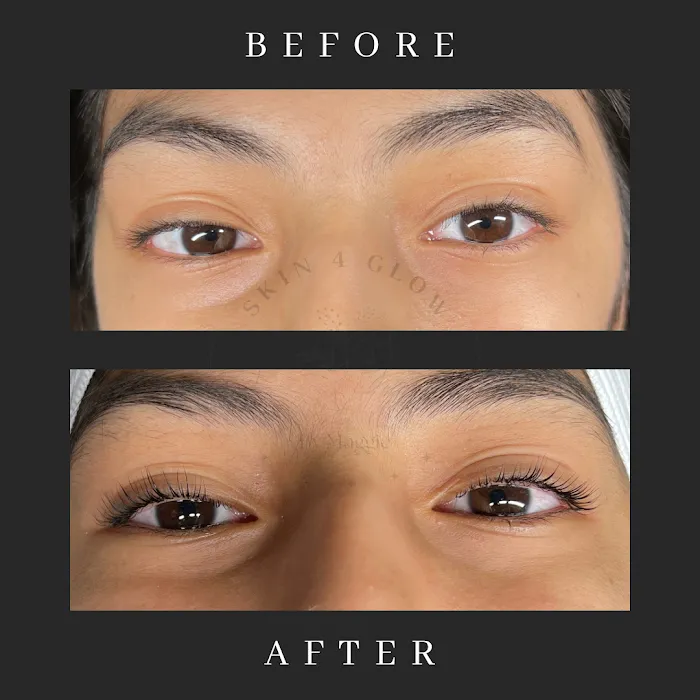 Skin 4 Glow Inc Picture 5