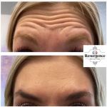 Resurgence Skin Care Center