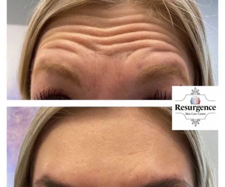 Resurgence Skin Care Center