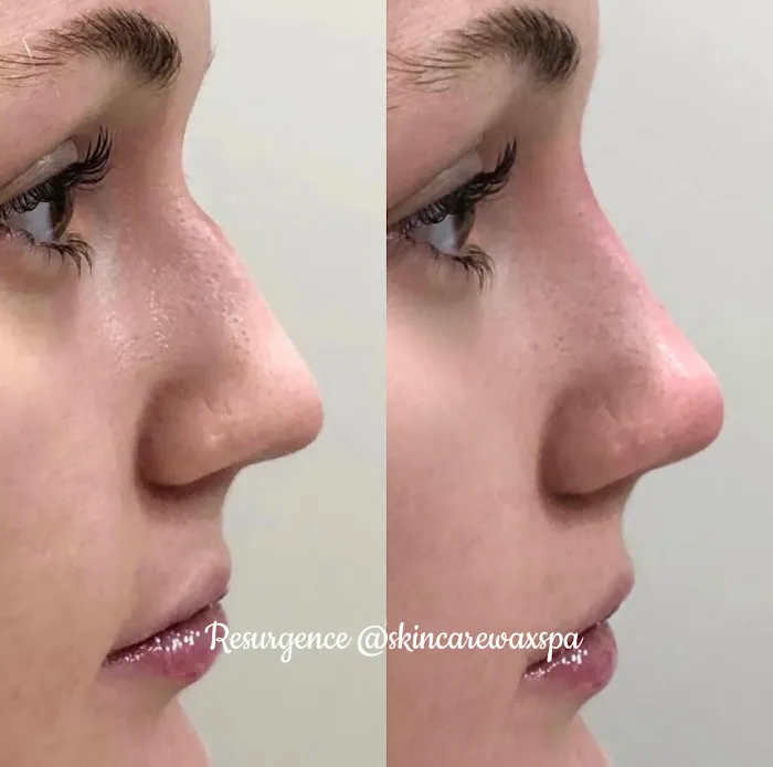 Resurgence Skin Care Center Picture 3