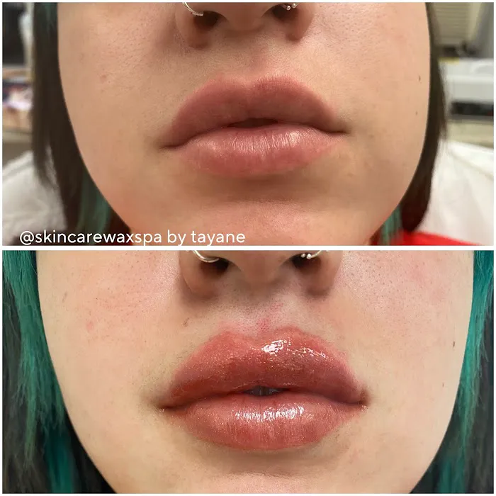 Resurgence Skin Care Center Picture 4